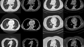 This new technology can help predict if you're going to die