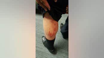 Birmingham, Ala. mayor, city councilman hug it out after bloody fight