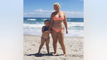 Woman calls stretch marks 'glitter stripes' in viral body confidence post