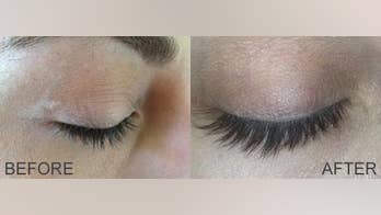 Will You Get Longer, Darker Lashes with Latisse?