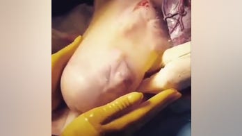 Video shows baby born inside amniotic sac
