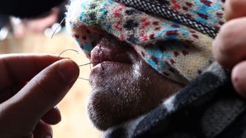 Iranian refugees sew mouths shut to protest French camp demolition