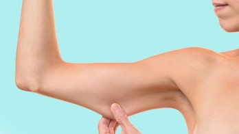 The extreme methods women are using to get rid of arm flab