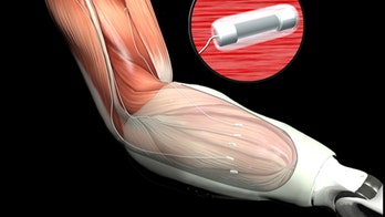 Mind-controlled limbs could restore sense of touch to combat casualties