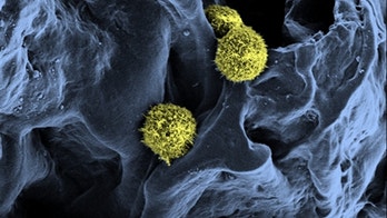 Artificial bone marrow could be used to treat leukemia