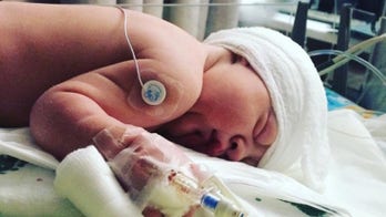 Utah boy defies odds to live after being born missing the back of his skull