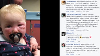 Banana Boat sunscreen caused toddler's second-degree burns, mom claims