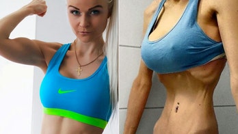 Barbie-inspired blogger overcomes anorexia after eating disorder nearly killed her