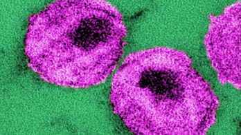 HIV-related deaths still high but declining among blacks, CDC says