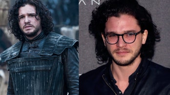 Kit Harington auditioned for 'Game of Thrones' with a black eye
