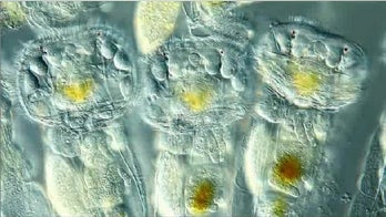 Stunning images of larva brains, butterfly scales nab prizes