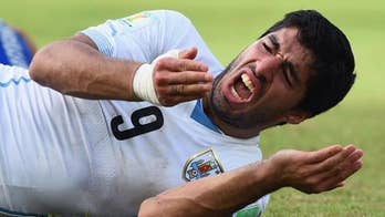 "HE BIT ME!" World Cup's Chompgate!