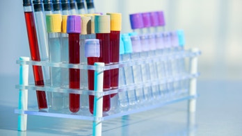 FDA takes steps to protect blood supply in Florida amid Zika probe