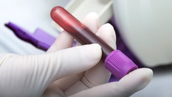 Experimental blood test could speed autism diagnosis, study claims