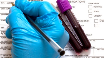 Study paves way for simple blood test to predict onset of Alzheimer's