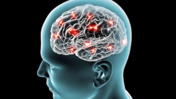 New test could improve diagnosis of rare, fatal brain disorder