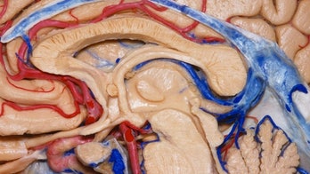 3D brain maps guide doctors — via iPhone