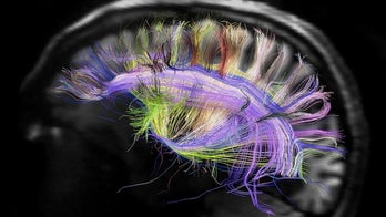 Ultrasound may boost brain performance
