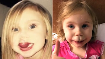 Life-changing surgery offers hope for toddler with debilitating facial birthmark