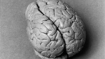 Identity of famous 19th-century brain discovered