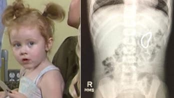 Colorado toddler swallows 28 Buckyball magnets, parents say
