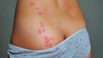 15 Tips for Avoiding Hotel Bedbugs