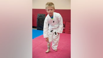 California boy to get new prosthetic leg after beach theft