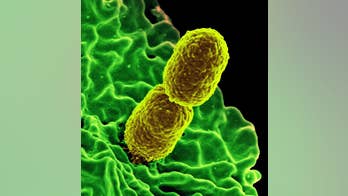 'Nightmare' superbug may have spread outside hospitals