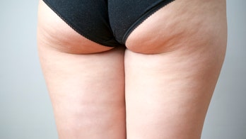 Fitness blogger hits back after Instagram removes pic of her cellulite