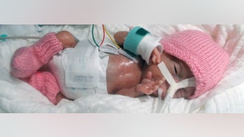 'World's smallest baby' thriving after premature birth