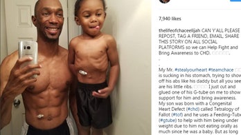 Dad makes G-tube to match son with congenital heart defect
