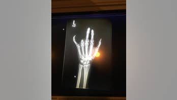 Scariest health stories of 2017