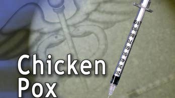 Chickenpox cases drop 80 percent in last decade