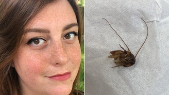 Woman lived with cockroach in her ear for 9 days after it crawled in while she was sleeping