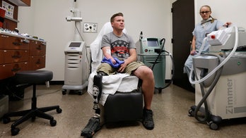 Combat wounded push medical science in field of prosthetics
