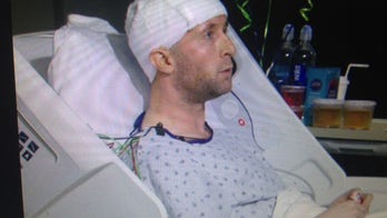 Comedian beaten with bat onstage by fellow comedian