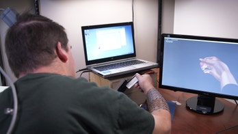 Device harnessing thoughts allows quadriplegic to use his hands