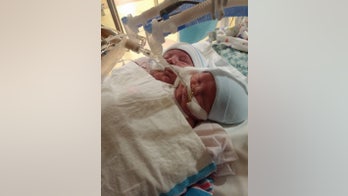 Conjoined twins born at Cincinnati Children's Hospital won't be separated