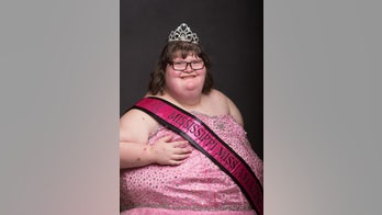A 380-lb girl with a genetic disorder that causes constant hunger crowned a pageant queen