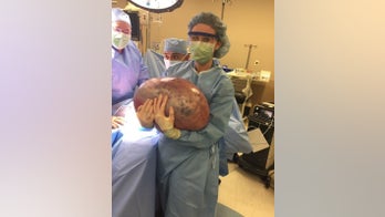 GRAPHIC IMAGES: Alabama woman's 50-pound weight gain turns out to be massive ovarian cyst