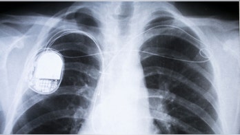 Hack-proof pacemakers: Code based on heartbeat could thwart disruption
