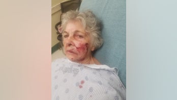 New Hampshire woman mauled in face by rabid bobcat