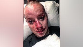 Deputy's graphic Facebook post describing fight with suspect goes viral