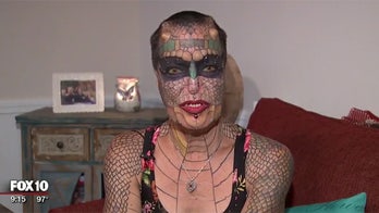 'The Dragon Lady': Plastic surgeon warns on dangers of body modification