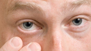 Bad habits put many contact-lens wearers at risk of eye infection