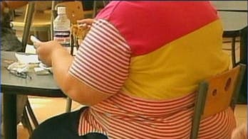 Scientists find how obesity gene works, a clue to treatment