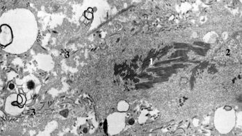 Ebola survivor's blood could lead to future vaccine