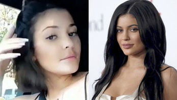 Kylie Jenner reveals on Instagram she removed lip filler