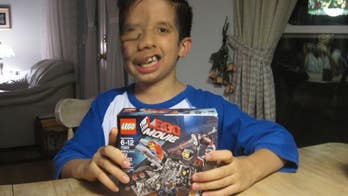 Texas boy born with rare condition opts not to undergo life-changing surgery