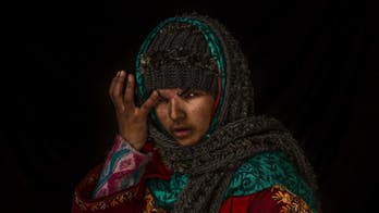 Pellets fired to quell protests blind hundreds of Kashmiris